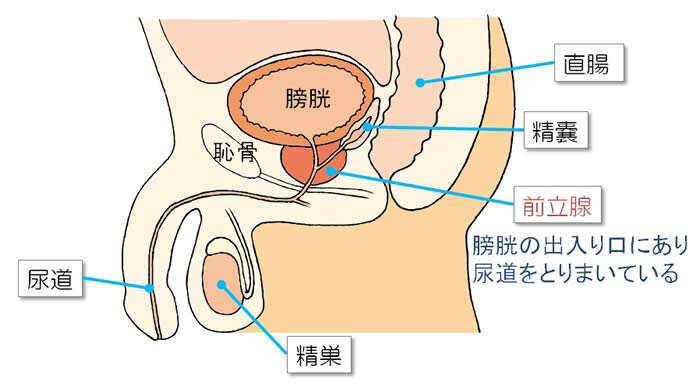 前立腺 男性特有の前立腺がんは血液検査で早期発見できる 進行と症状 ...